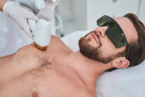 إزالة شعر العانة بالليزر للرجال