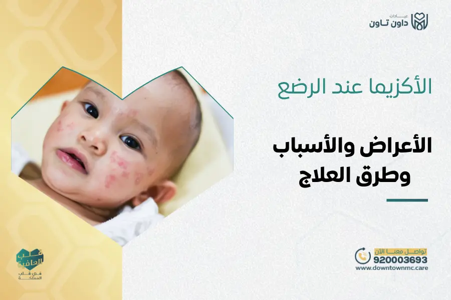 الأكزيما عند الرضع