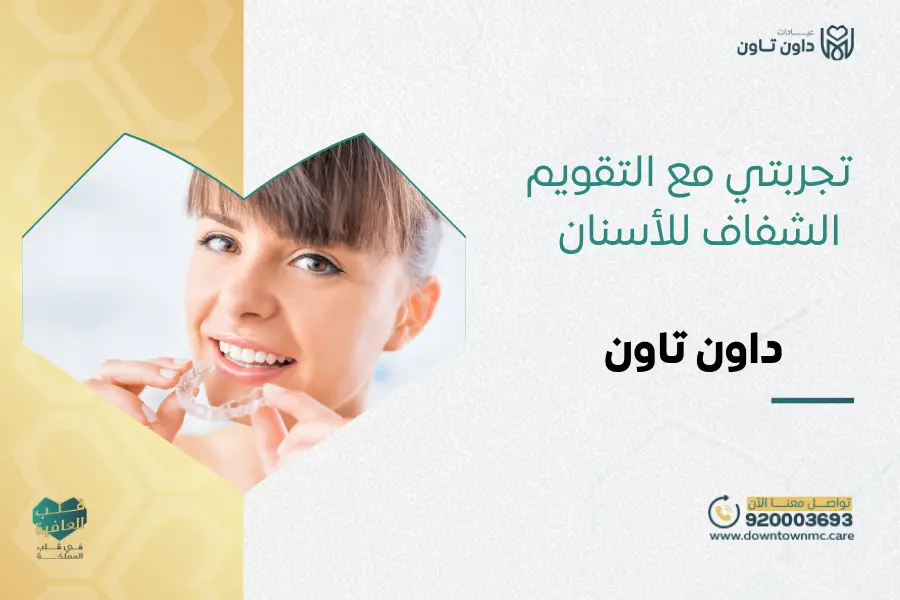 تجربتي مع التقويم الشفاف للأسنان