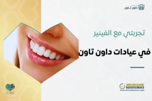 تجربتي مع الفينير في عيادات داون تاون