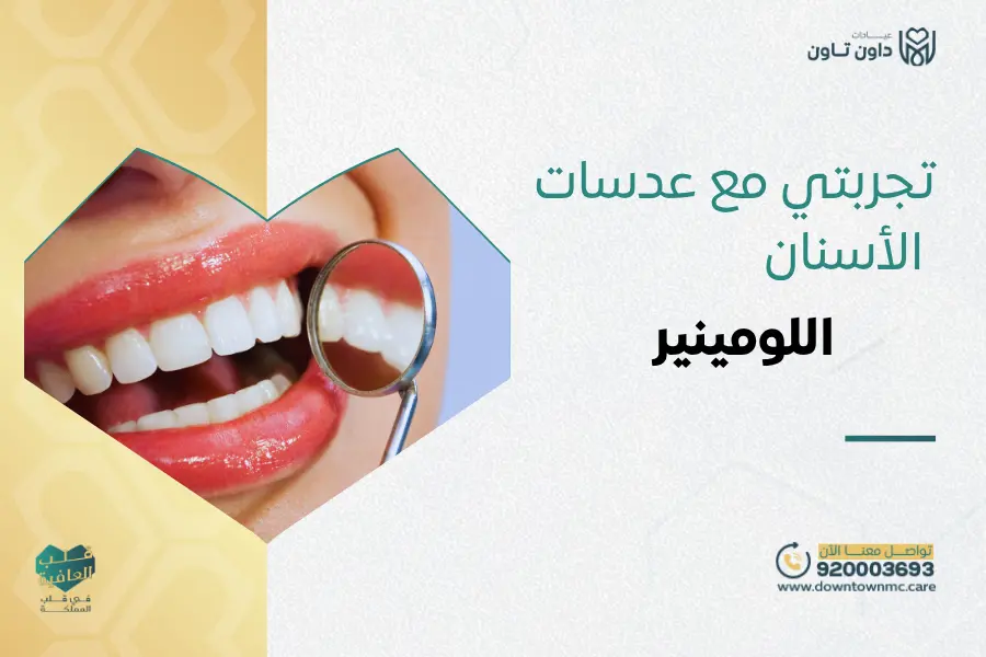 تجربتي مع عدسات الأسنان اللومينير