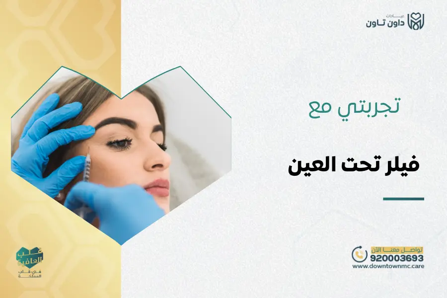 تجربتي مع فيلر تحت العين