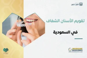 تقويم الأسنان الشفاف​ في السعودية