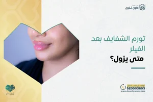 تورم الشفايف بعد الفيلر