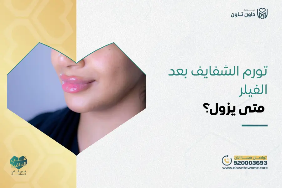 تورم الشفايف بعد الفيلر