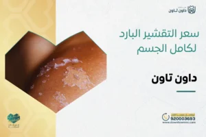 سعر التقشير البارد لكامل الجسم في داون تاون