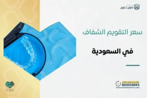سعر التقويم الشفاف في السعودية
