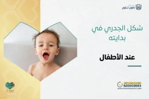 شكل الجدري في بدايته.