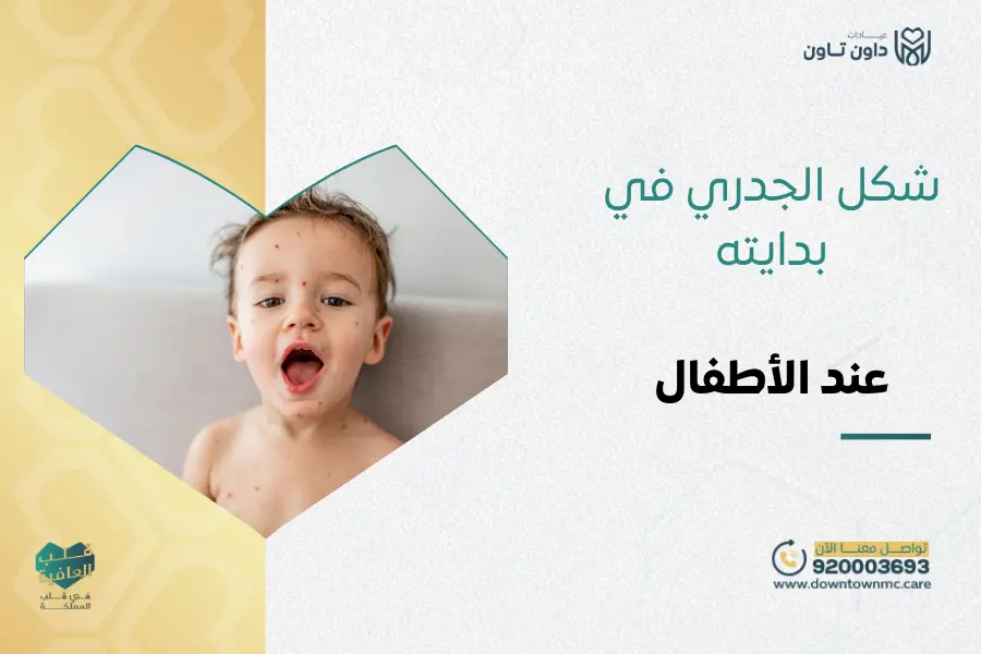 شكل الجدري في بدايته
