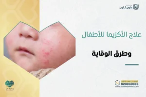 علاج الأكزيما للأطفال وطرق الوقاية