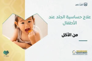 علاج حساسية الجلد عند الأطفال من الأكل