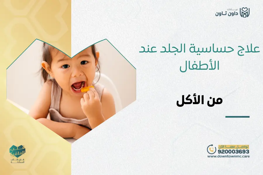 علاج حساسية الجلد عند الأطفال من الأكل