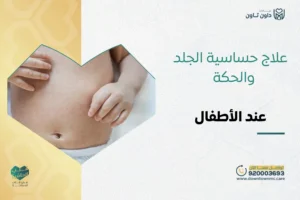 علاج حساسية الجلد والحكة عند الأطفال