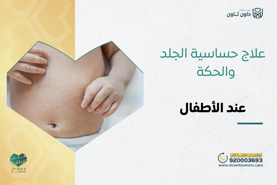 علاج حساسية الجلد والحكة عند الأطفال