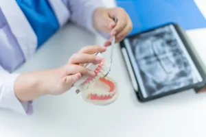 عيادات جذور الأسنان