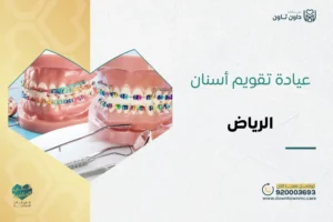 عيادة تقويم أسنان الرياض