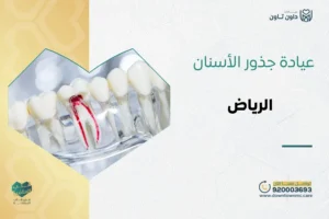 عيادة جذور الأسنان في الرياض