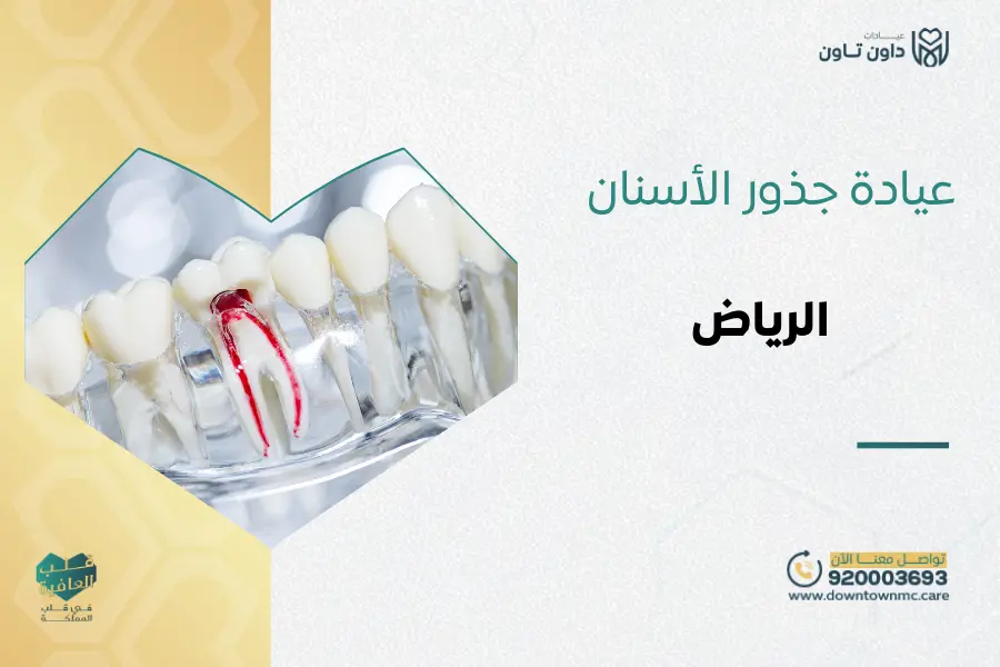 عيادة جذور الأسنان في الرياض