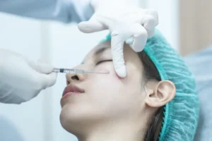 فيلر تحت العين كم يدوم تجربتي مع حقن الفيلر تحت العين قبل وبعد