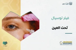 فيلر توسيال تحت العين