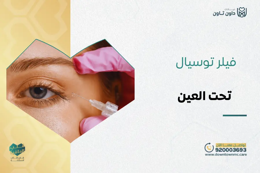 فيلر توسيال تحت العين
