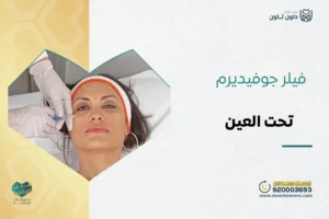 فيلر جوفيديرم تحت العين