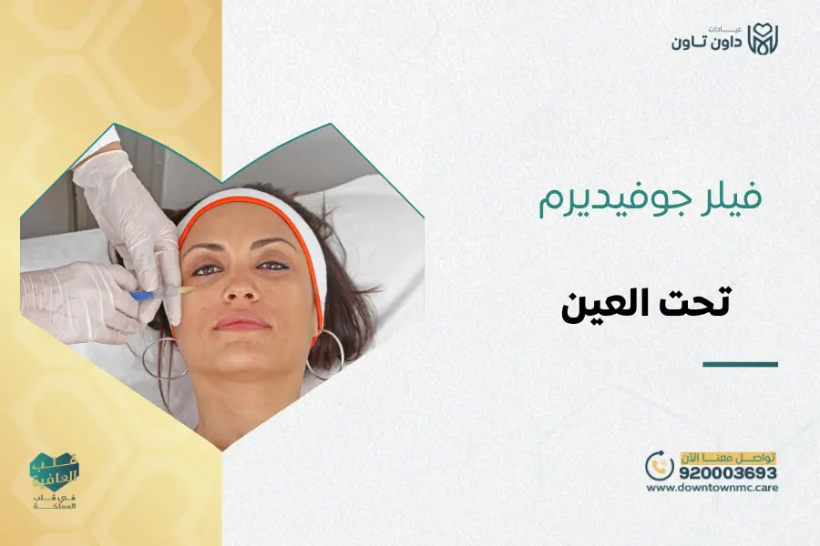 فيلر جوفيديرم تحت العين