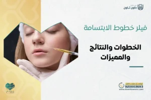 فيلر خطوط الابتسامة