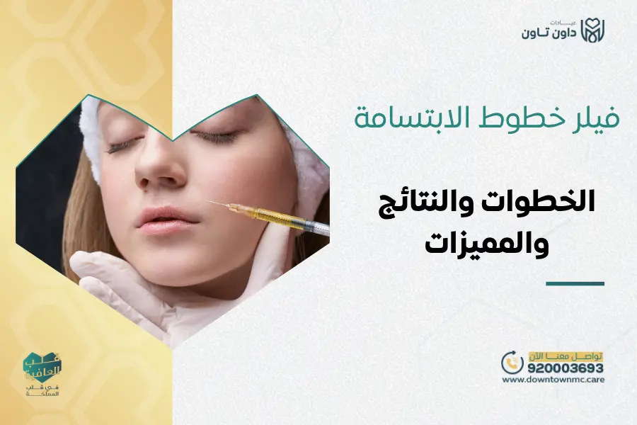 فيلر خطوط الابتسامة