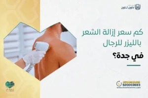 كم سعر إزالة الشعر بالليزر للرجال في جدة؟
