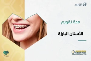 كم مدة تقويم الأسنان البارزة