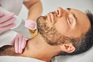 مراكز إزالة الشعر بالليزر للرجال