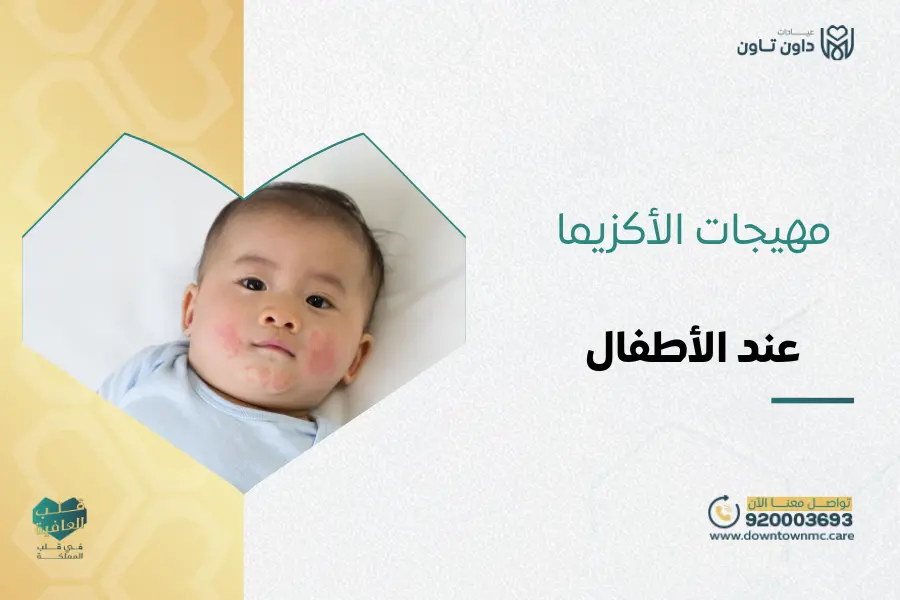 مهيجات الأكزيما عند الأطفال