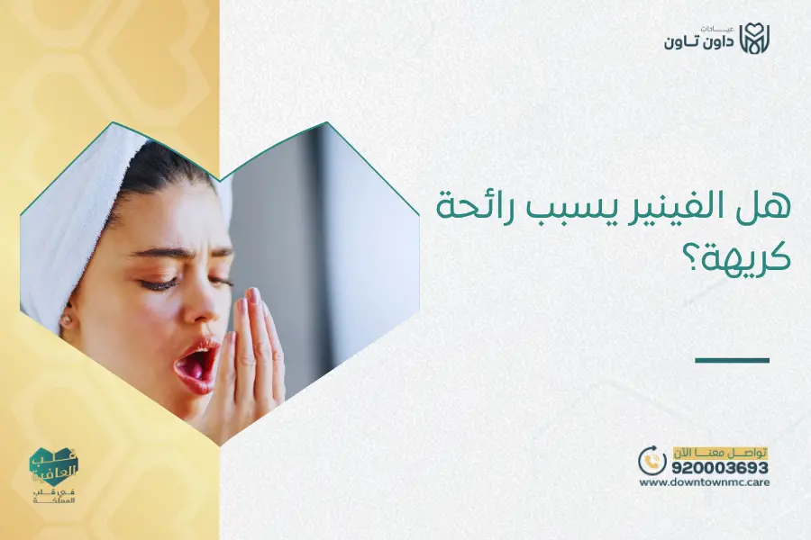 هل الفينير يسبب رائحة كريهة؟