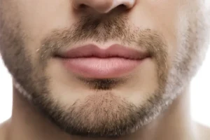 وجه تكساس للرجال قبل وبعد