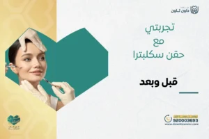 تجربتي مع حقن سكلبترا قبل وبعد