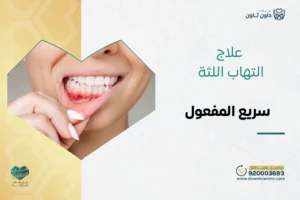 علاج التهاب اللثة سريع المفعول في داون تاون السعودية