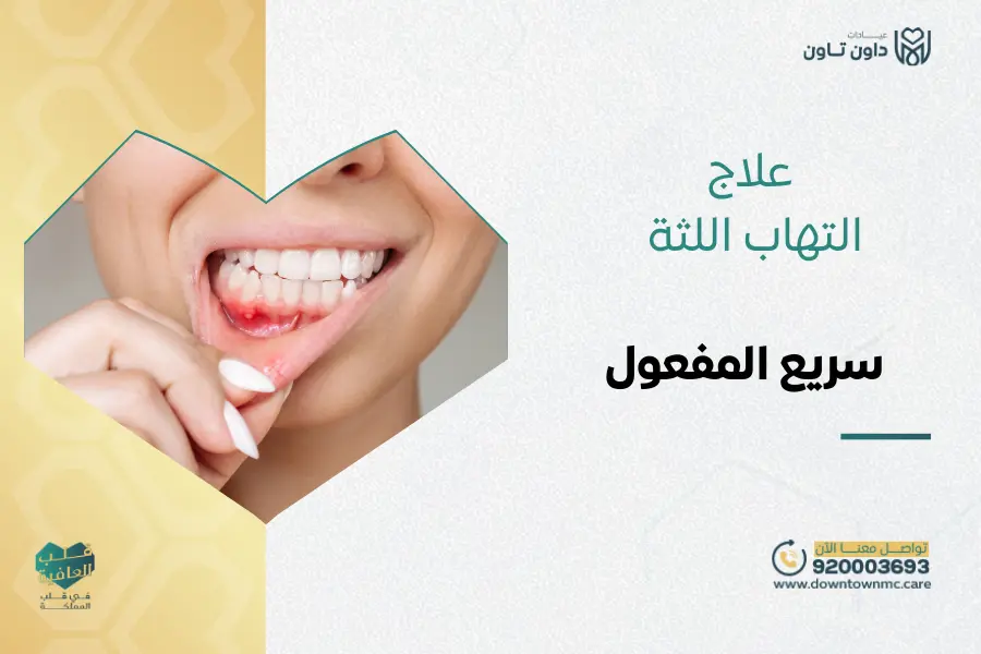 علاج التهاب اللثة سريع المفعول في داون تاون السعودية