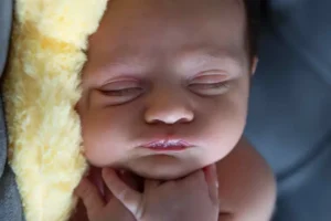 علاج الصفار عند حديثي الولادة بالبيت بالضوء