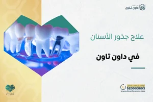 علاج جذور الأسنان بأحدث التقنيات