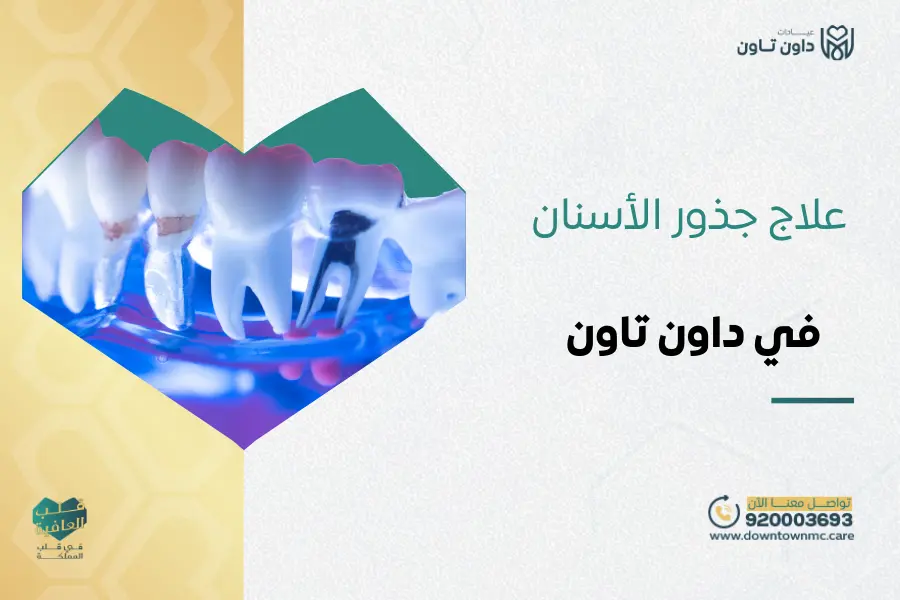 علاج جذور الأسنان بأحدث التقنيات