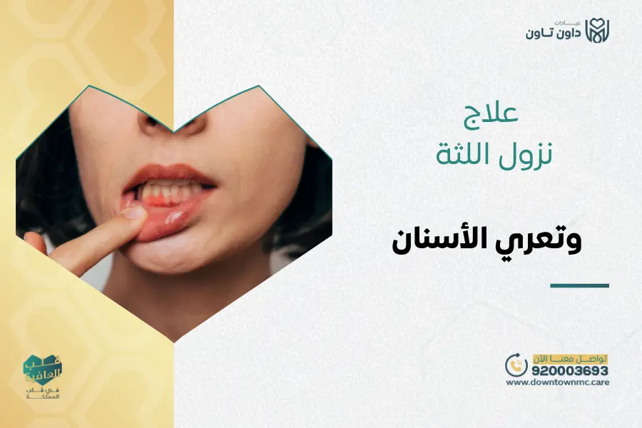 علاج نزول اللثة وتعري الأسنان وأشهر 7 طرق في داون تاون