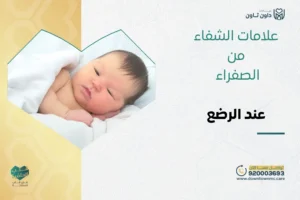 علامات الشفاء من الصفراء عند الرضع