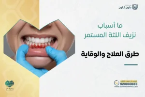 ما أسباب نزيف اللثة المستمر وطرق العلاج والوقاية؟