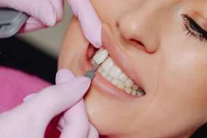 أضرار عدسات الأسنان