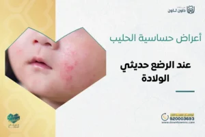 أعراض حساسية الحليب عند الرضع حديثي الولادة والعلاج