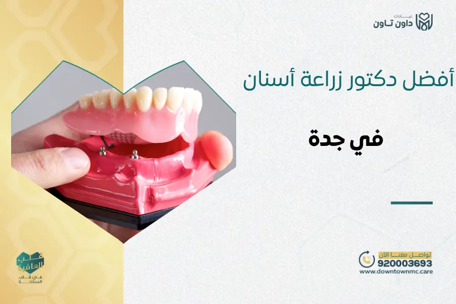 أفضل دكتور زراعة أسنان في جدة