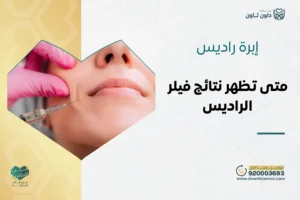 إبرة راديس المكونات ومتى تظهر نتائج فيلر الراديس