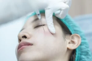 إبرة Lanluma للوجه