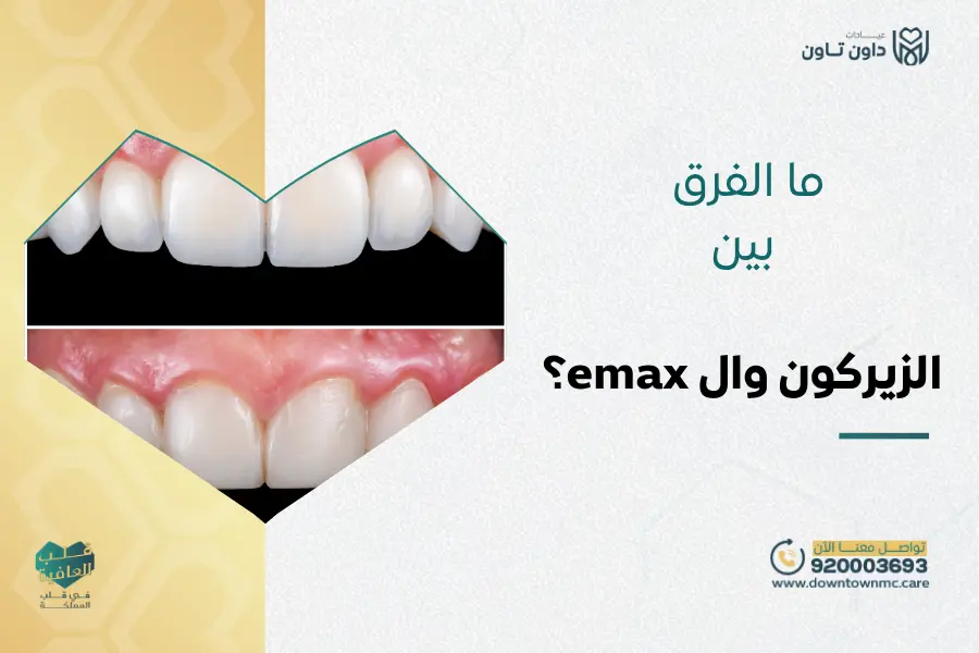 الفرق بين الزيركون وال emax
